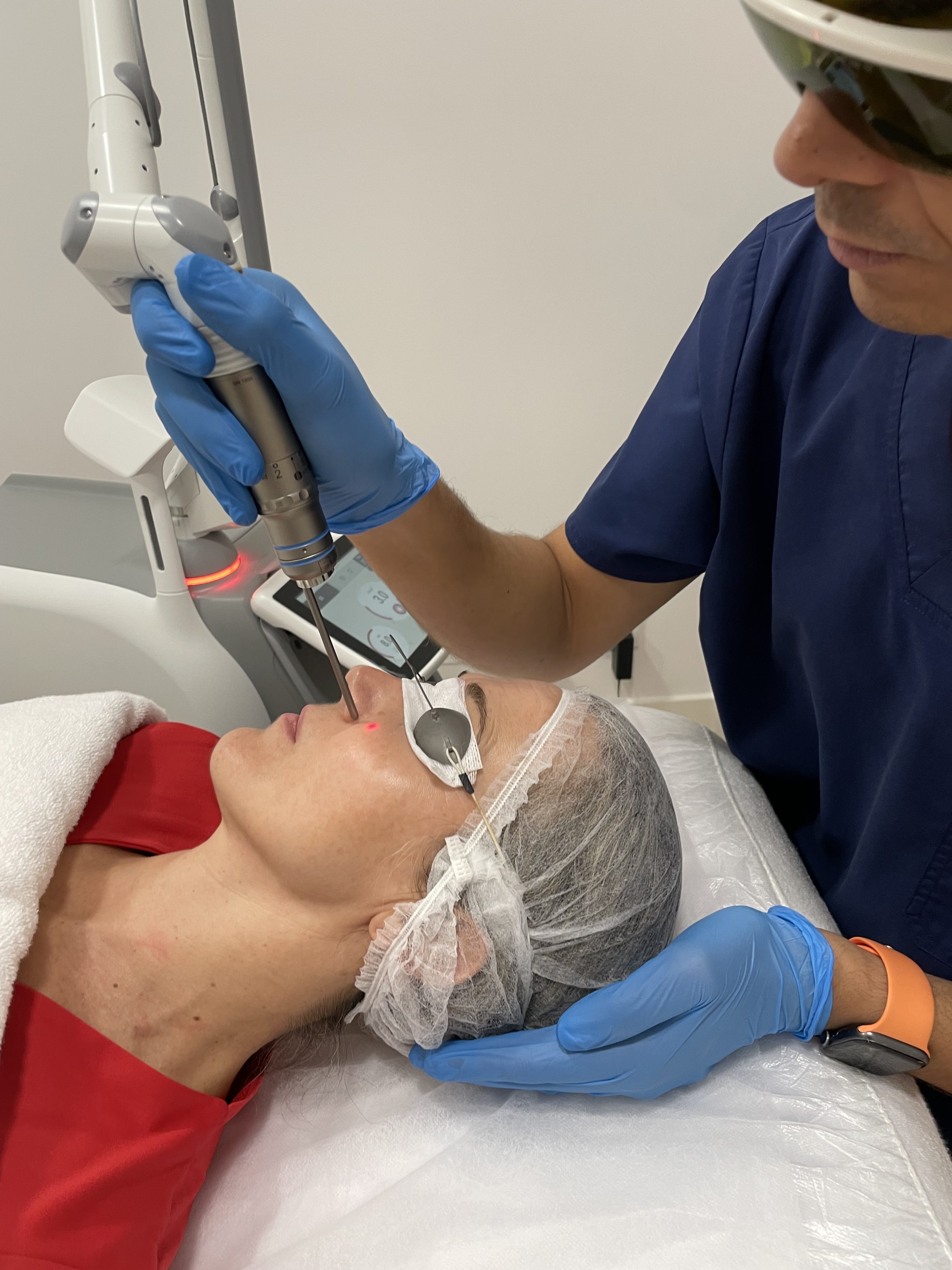 Melasma picosegundos