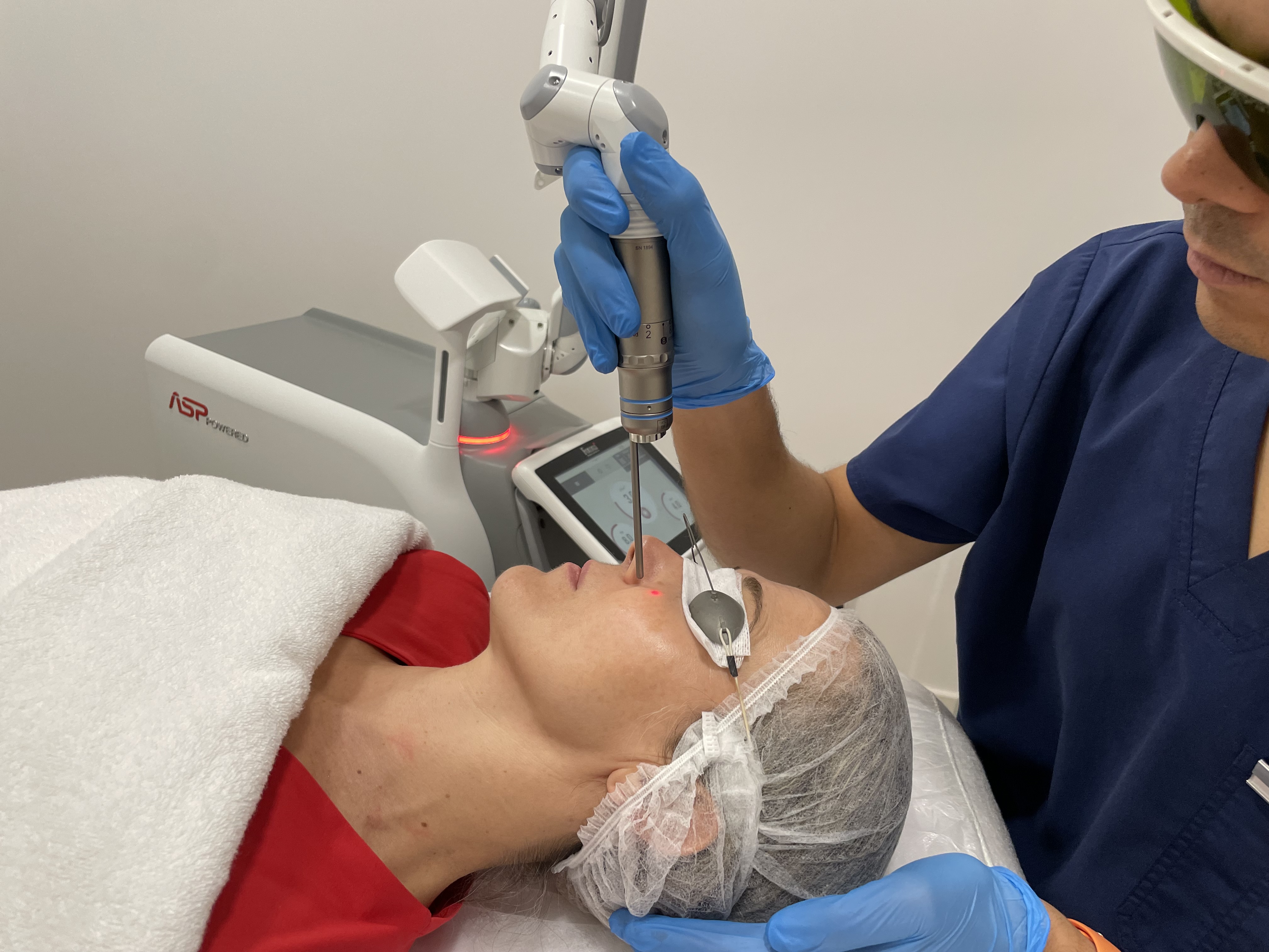 Tratamiento melasma picosegundos