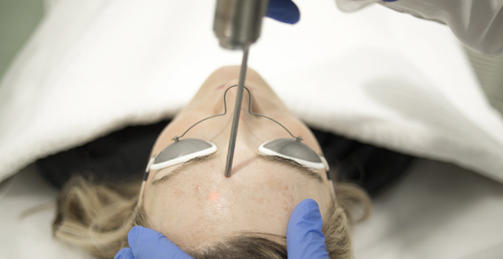 Tratamiento melasma