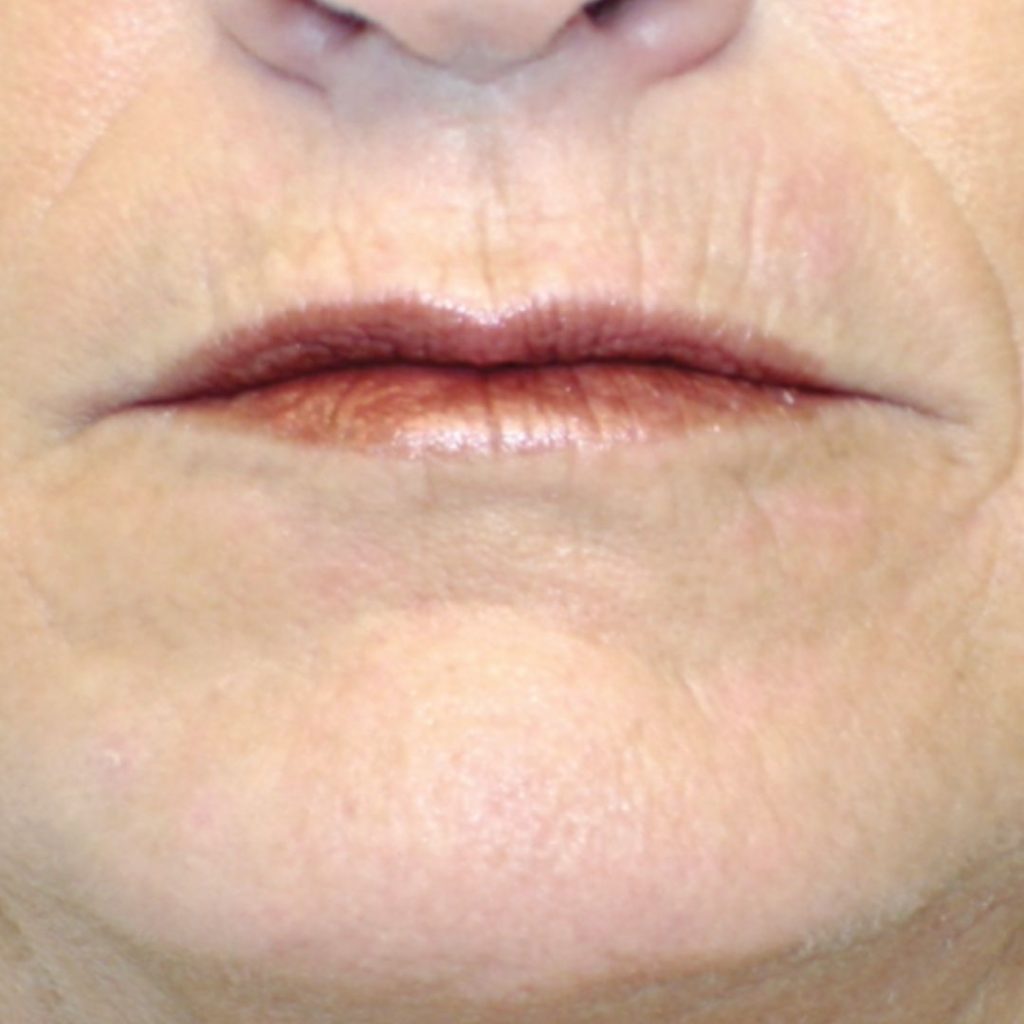 Código de barras labio