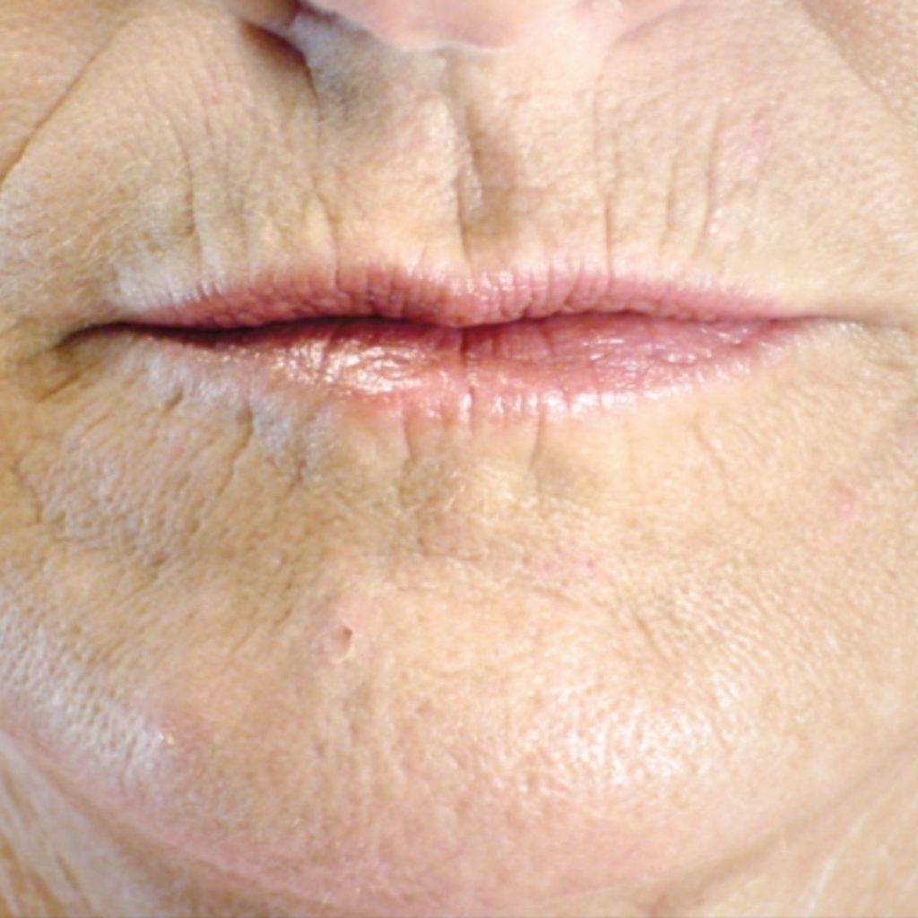 Código de barras labio