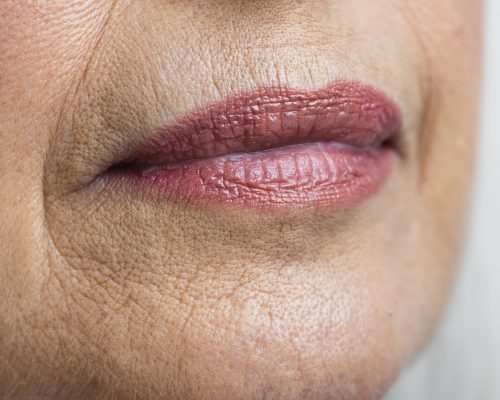 plink lips